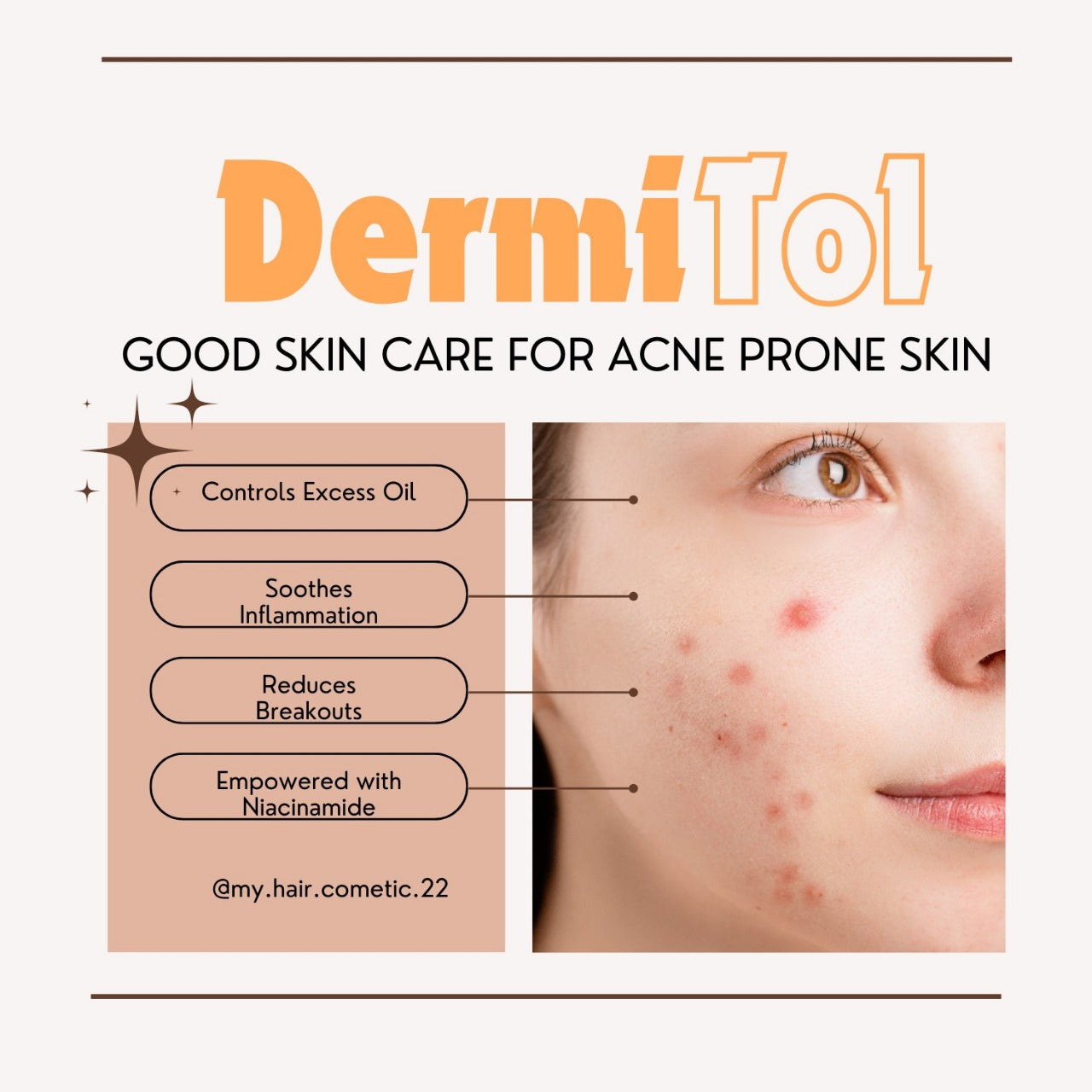 Dermi Tol Anti Acne Cream 50 ML