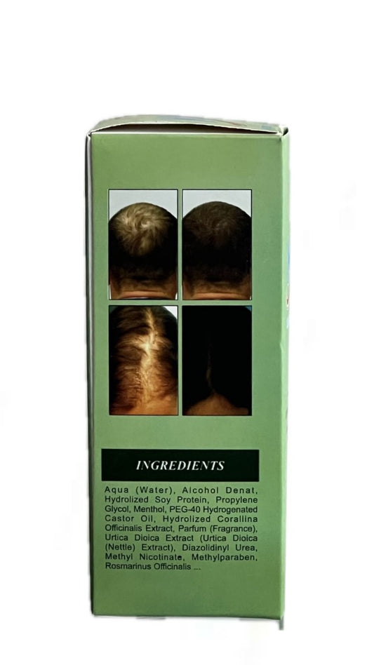 Hair Regrowth Lotion for Men & Women